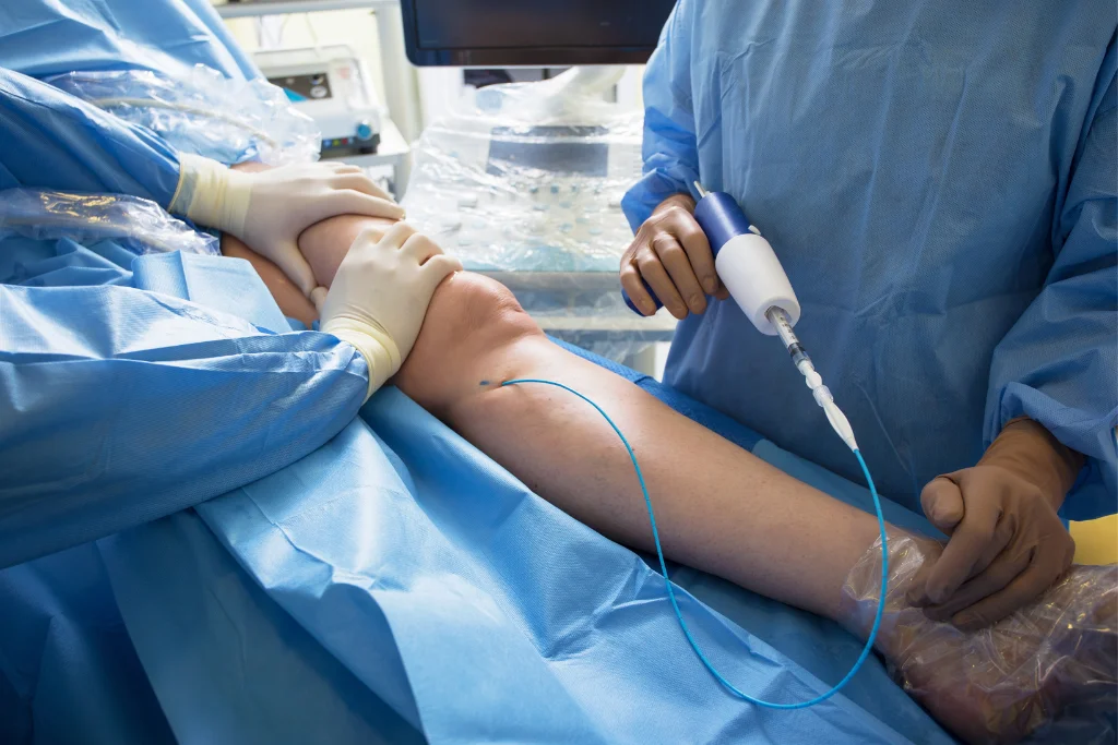 Growing Need For Specialized Vein Treatment