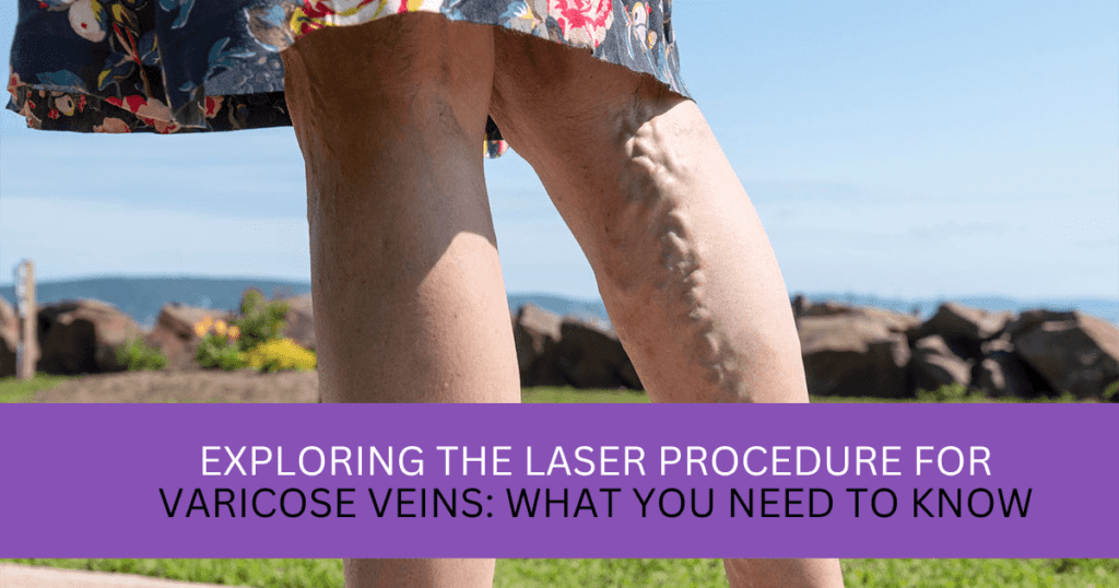 Laser Procedure for Varicose Veins