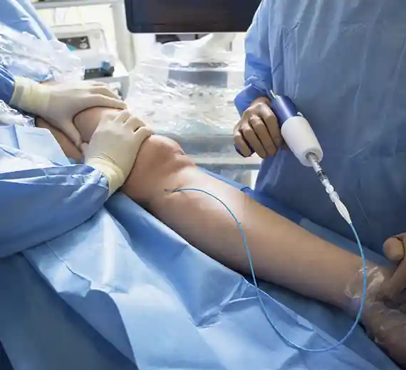 Explore our Best Vein Treatment Insurance Coverage