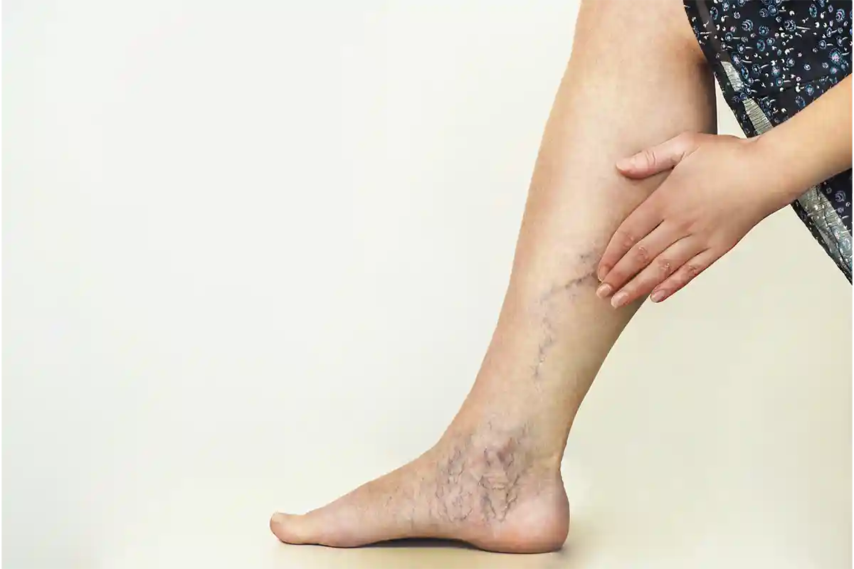 Our Vein Clinic Specialized Treatments