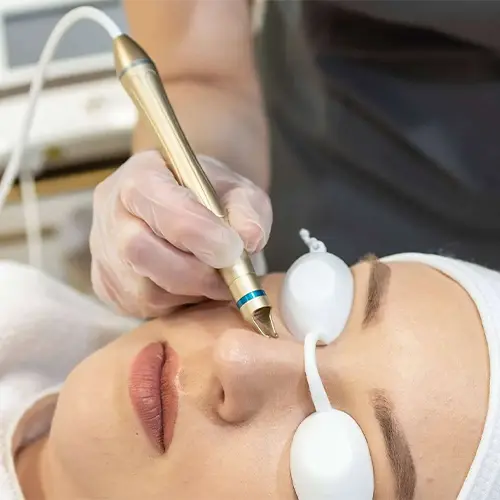 Facial Vein Treatment Options