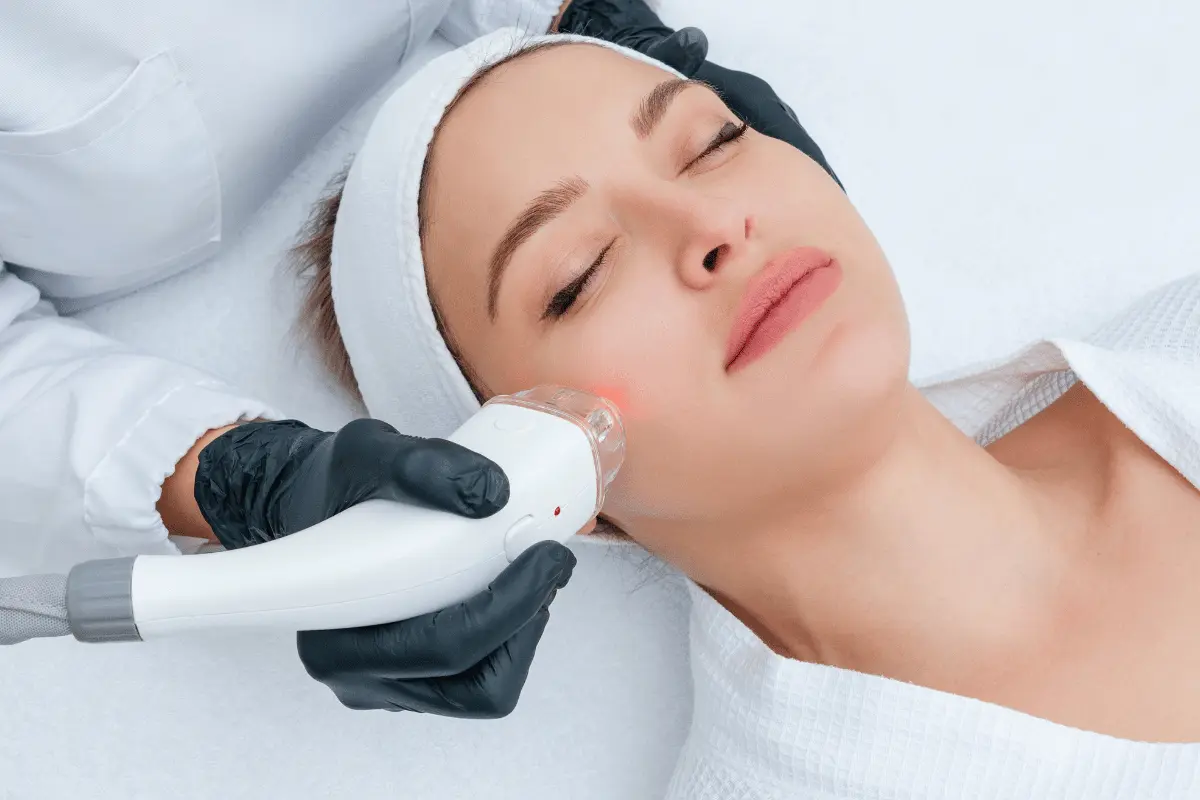How Treatment for Facial Spider Veins Works