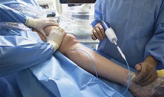 What to Expect from Large Varicose Vein Removal