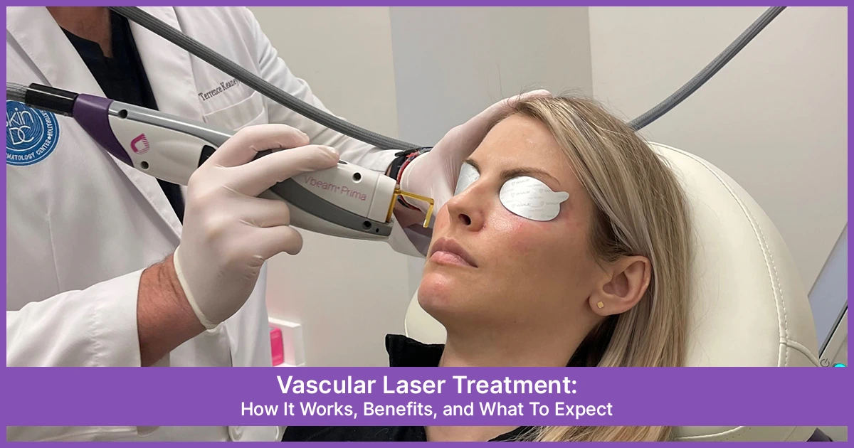 Vascular Laser Treatment