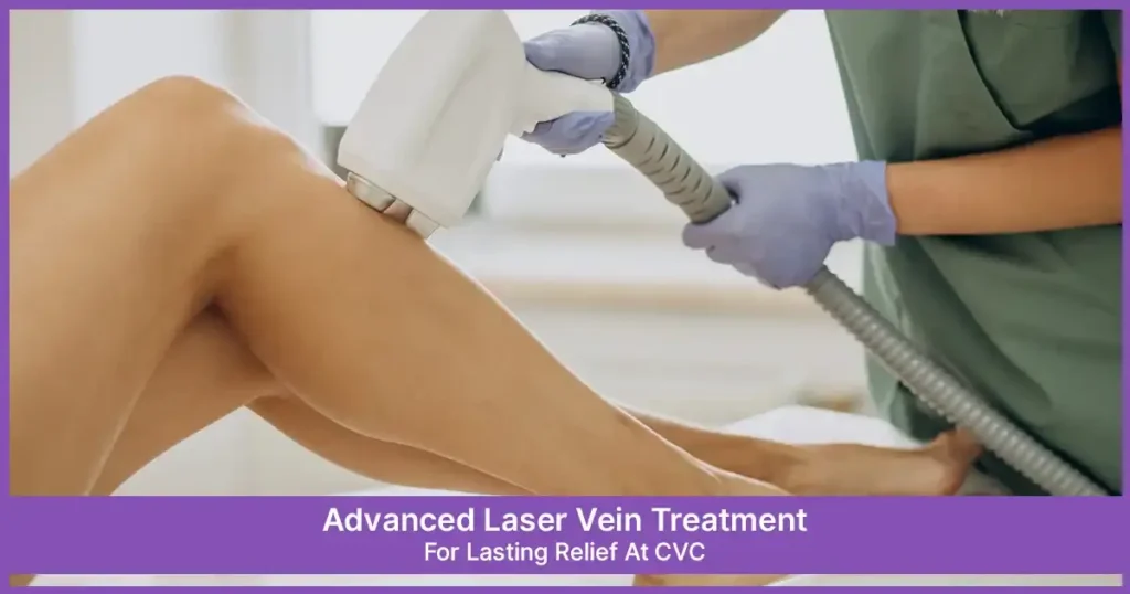 Laser Vein Treatment