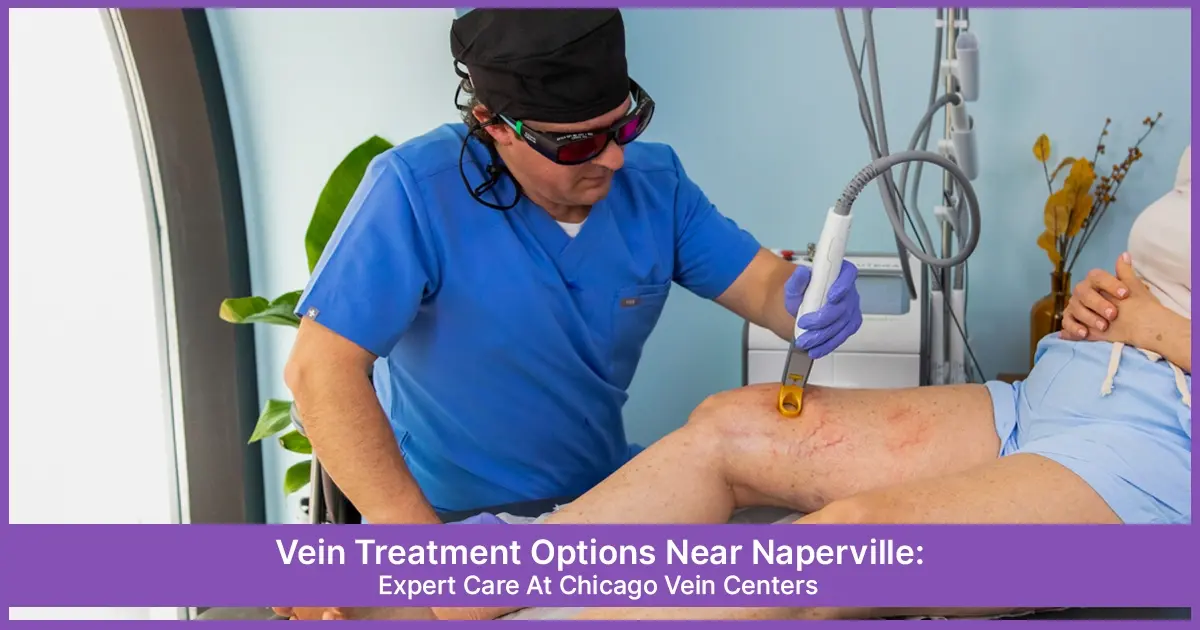 Vein Treatment Near Naperville